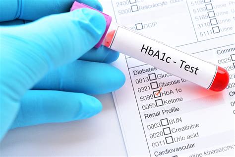 HbA1c Test + Normal, Prediabetes & Di.